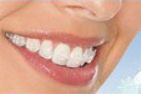 Ortodontia- Dr. Alexandre Eiji Nitatori - CROSP 67.993